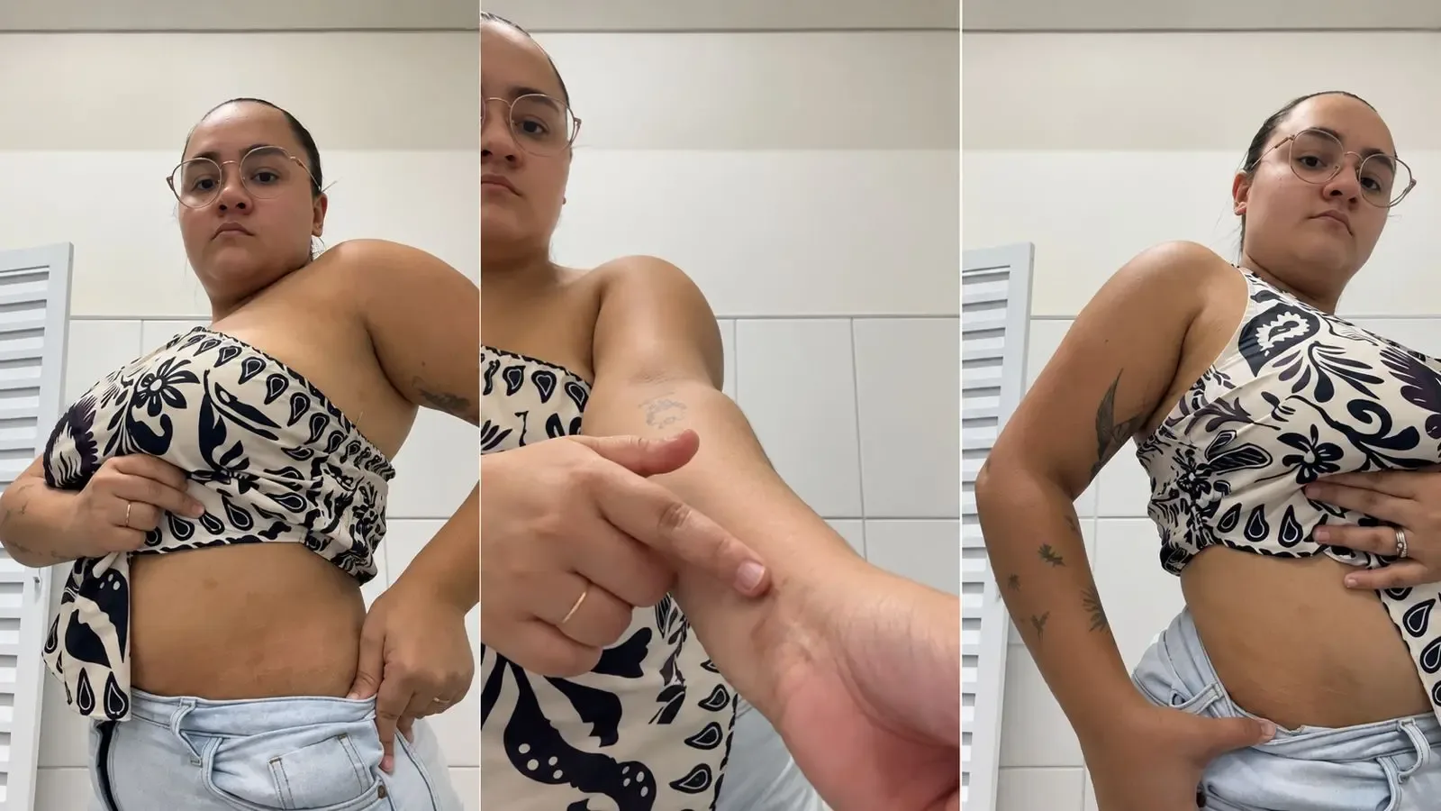 Psoríase pode mudar hábitos e exigir cuidado com a saúde emocional
